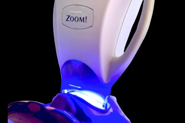 integra-clinic-blanqueamiento